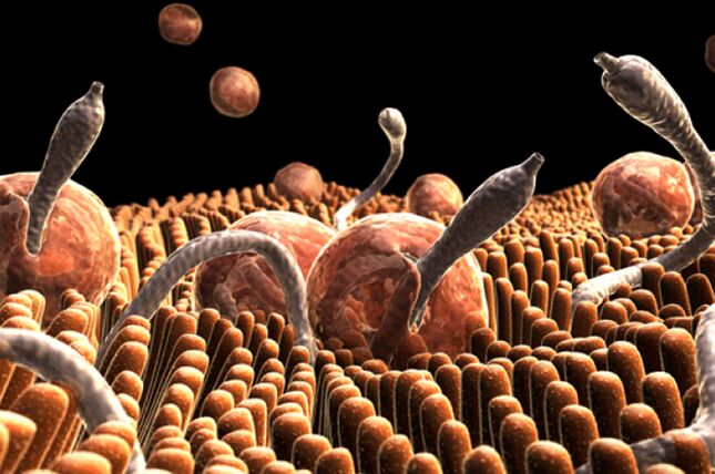 παράσιτα στο ανθρώπινο σώμα