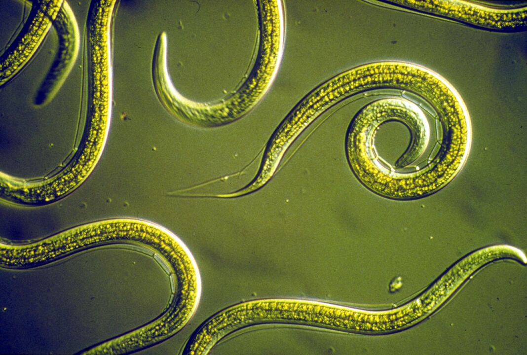 σκουλήκια pinworm από το ανθρώπινο σώμα